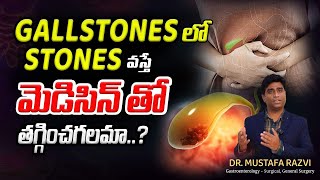 Treatment options for gallstones telugu  Gallstone SURGERY  Dr Mustafa Surgical Gastroenterology [upl. by Tammie]