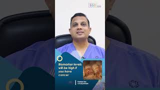 Biomarkers for Ovarian Cancer CA125 Vs HE4 Explained  Ovarian Cancer Diagnosis  Dr Nilesh [upl. by Harve]