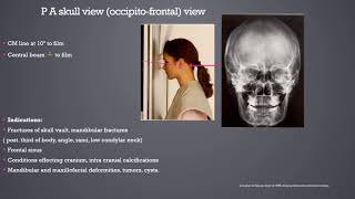 Extraoral Radiography [upl. by Clark]