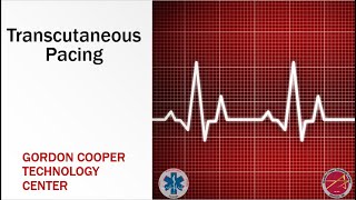 Paramedic Transcutaneous Pacing [upl. by Yborian]