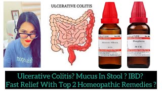 Colitis IBD Intestinal UlcerUlcerative Colitis Best Homeopathic Medicine By DrRukmani Choudhary [upl. by Jason431]