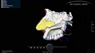 3D NASAL VISTA  Demo 03 [upl. by Mosira]