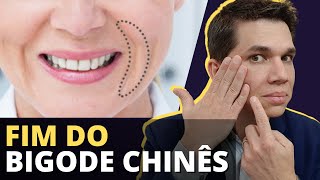 FIM DO BIGODE CHINÊS Como tratar e acabar DEFINITIVAMENTE com essa Ruga [upl. by Carlotta152]