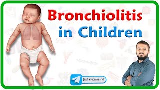 Bronchiolitis in Children  Etiology Clinical features Diagnosis Management and Complications [upl. by Eicram]