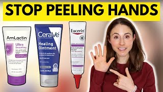 How to STOP SKIN PEELING ON THE HANDS amp FEET 🤔 Dermatologist DrDrayzday [upl. by Meuser]