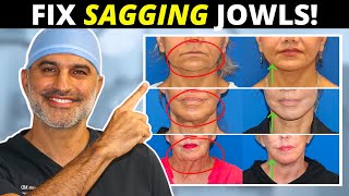 Sagging Jowls 101 How they form and what to do about them tighten and eliminate [upl. by Martguerita]