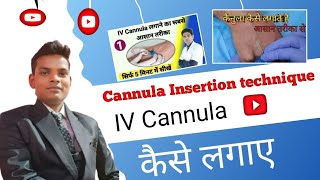 Cannula Insertion technique how To Insert IV Cannula doctor mbbs youtubevideo ivcannula shorts [upl. by Cort223]