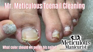 Mr Meticulous Satisfying Impacted Toenail Cleaning Holiday Specials Announcement [upl. by Antoinette707]