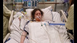 Extubation and first breaths after double lung transplant  Cystic Fibrosis [upl. by Andra]