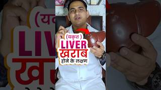 Liver ख़राब होने के क्या क्या लक्षण होते है । Liver cirrhosis  fatty liver viral shorts [upl. by Jason]