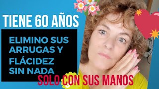 elimino ARRUGAS solo con sus manos  tiene 60 años [upl. by Adnirolc932]