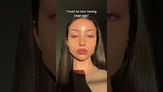 How to get clear skin in 1 week acneproneskincareroutine clearskin skincareroutine acneclear [upl. by Enaek]