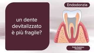 Endodonzia che cosè [upl. by Einhpets]