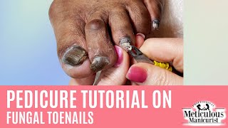 How to Pedicure on Thick Dark Toenails with Nail Fungus [upl. by Reivilo]