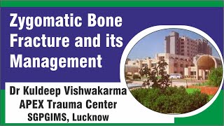 Zygomatic Bone Fracture and its Management [upl. by Shulem]