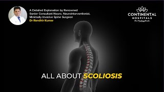 Scoliosis Explained Causes Symptoms amp Treatment Options  Dr Randhir Best Neurosurgeon Hyderabad [upl. by Buxton182]