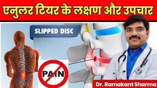 Slip Disc Types and Annular Tear Causes Symptoms and Treatment Explained drramakantsharma7 [upl. by Ashby]