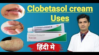 Clobetasol Propionate cream uses  Tenovate cream Uses in hindi [upl. by Birk]