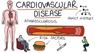 Understanding Cardiovascular Disease Visual Explanation for Students [upl. by Eillen184]