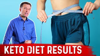 Keto Diet Results – What to Expect – Dr Berg [upl. by Dallman]