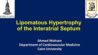 Lipomatous hypertrophy of the Interatrial Septum Lipomatous atrial septal hypertrophy LASH [upl. by Niccolo]