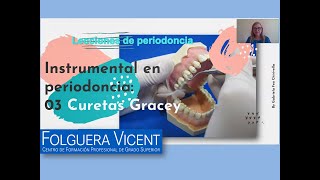 Lecciones de periodoncia Nº3 Curetas Gracey [upl. by Ayifa796]