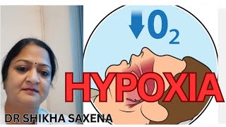 Hypoxic Classification of Hypoxia Telegram httpstmedrshikhasaxenahumanphysiology [upl. by Norris]