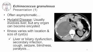 Echinococcus multilocularis life cycle [upl. by Euqinot]