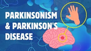 Understanding Parkinsonism and Parkinsons Disease [upl. by Elraet]