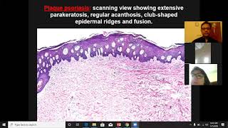 Lecture 4 Dermatopathology Psoriasiform and Spongiotic dermatoses [upl. by Arvo]