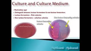 Bacteriology Culture Types of culture medium and their uses [upl. by Hnahk101]