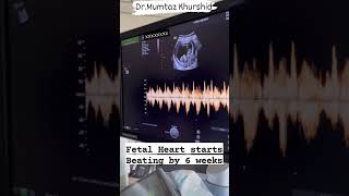 Fetal Heart Beat On Ultrasound Scan [upl. by Urquhart]