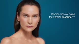 Discover RADIESSE® for the décolleté [upl. by Breger]