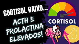 Cortisol BaixoACTH e Prolactina Elevados [upl. by Elleirua]