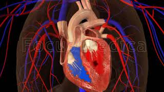 Atrial Fibrillation  Animated Atlas of Atrial Fibrillation [upl. by Beryl]