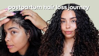 Postpartum hair loss journey  what Im using to regrow my hair line [upl. by Nekcerb848]