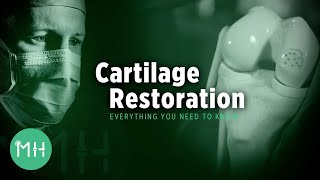 Cartilage Restoration  Everything you need to know [upl. by Castra258]