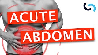 Acute Abdomen  Diagnosis and Management [upl. by Lesoj906]