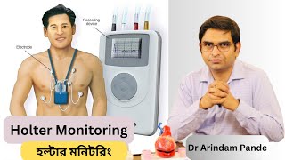 হল্টার মনিটরিং I Holter Monitoring Different types When needed What it detects  Dr Arindam Pande [upl. by Trenna]