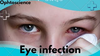 What is an eye infection Treatment symptoms  cause  prevention [upl. by Egdirdle]