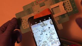 Using the foldscope to collect parasite egg images a demo [upl. by Ahseiyn]