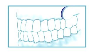 Oral Science  Utilisation des pastilles adhérentes XyliMelts [upl. by Salvadore597]