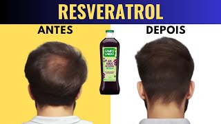 RESVERATROL E CALVÍCIE MASCULINA [upl. by Sitsuj]