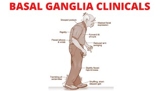 The Basal Ganglia Clinical Anatomy  Parkinson’s Disease  Chorea  Huntington Disease [upl. by Terri]