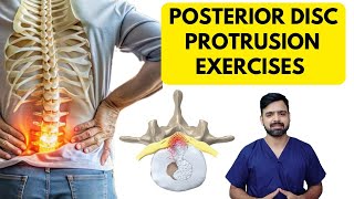 Posterior Disc Protrusion L4L5 L5S1  Exercise  Dr Sunil Physio [upl. by Riccardo]