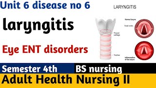 Laryngitis  Acute  Chronic  Symptoms  Causes  Voice Hoarseness Nursing Lecture in Urdu Hindi [upl. by Latricia]