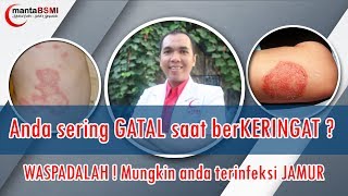 Gatal selangkangan  GATAL saat berKERINGAT  Kulit anda JAMURAN [upl. by Rosette]