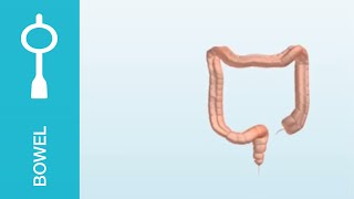 Peristeen  scintographics showing the bowel before and after Peristeen use [upl. by Garlanda74]