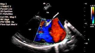 Degenerative Mitral Valve Disease in dogs [upl. by Strong973]