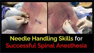 Successful Spinal Anesthesia  Skillful Needle Handling [upl. by Andras]